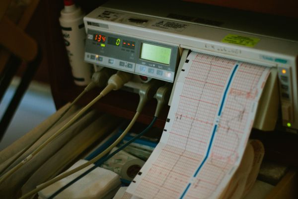 Electrocardiograph monitor display in a clinical setting